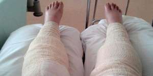 Wanita Ini Salah Cukur Bulu Kaki, Akibatnya Mengerikan