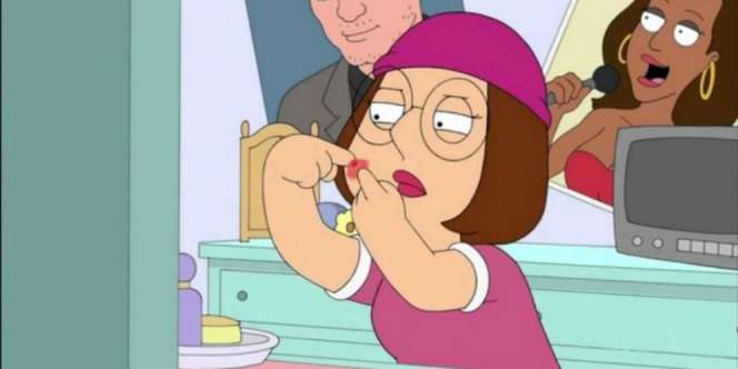 5 Penyebab Jerawat dan Cara Mengatasinya