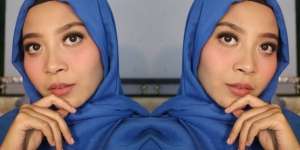 Girly Saputri: 3 Langkah Atasi Luka Percikan Minyak Panas