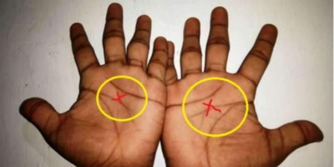 Hebatnya Mereka yang Memiliki Huruf X di Kedua Telapak Tangan