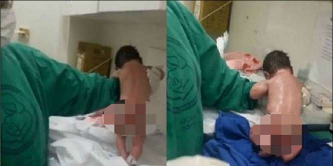 Allahu Akbar! Heboh Bayi Baru Lahir Langsung Berusaha Jalan!