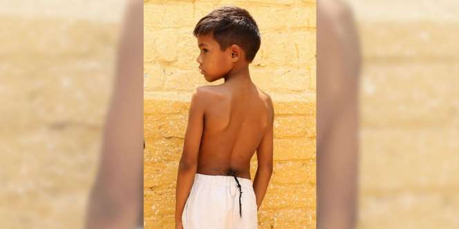 Geger Bocah Berekor, Dianggap Titisan Dewa