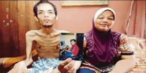 Doyan Minum Soda, Tubuh Pria Tinggal Tulang Terbungkus Kulit