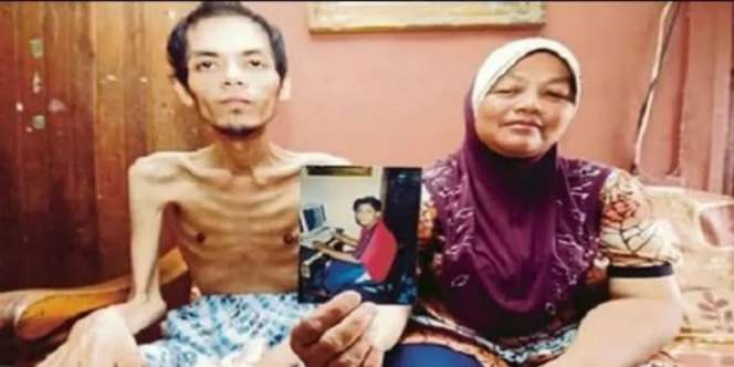 Doyan Minum Soda, Tubuh Pria Tinggal Tulang Terbungkus Kulit