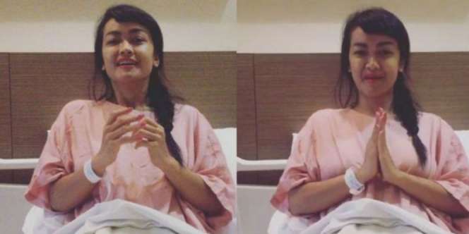 Foto Perubahan Fisik Jupe dari Sebelum Kanker hingga Berpulang