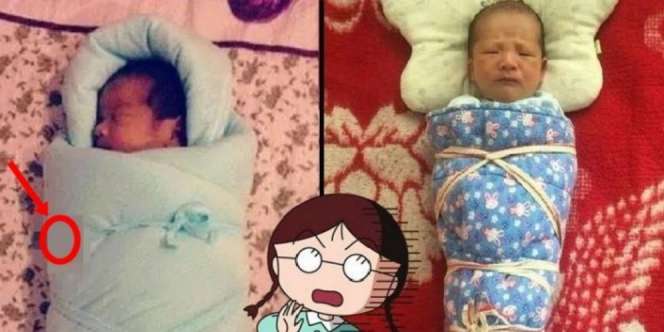 Dokter Periksa Pusar Bayi, Saat Buka Selimutnya Kaget Lihat...