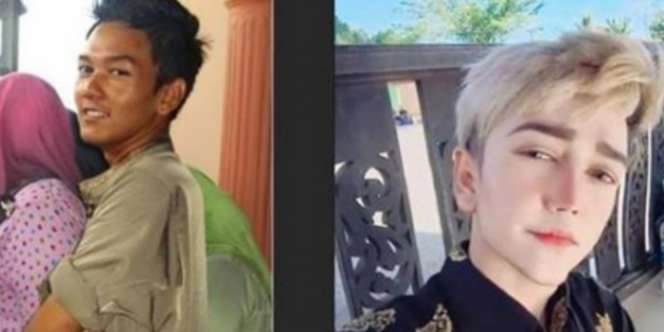 Si Pemuda Habiskan Setengah Miliar Buat Oplas, Demi Mirip...