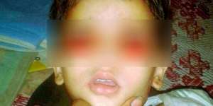 Misteri Tangisan Darah Balita Buat Dokter Keheranan
