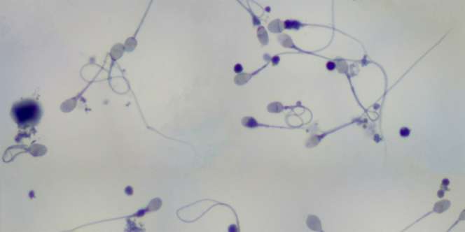 Mengenal Azoospermia, Pemicu Kemandulan Pria