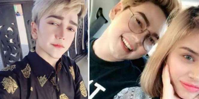 Terungkap, Fakta Sebenarnya Pria Berwajah `Anime`