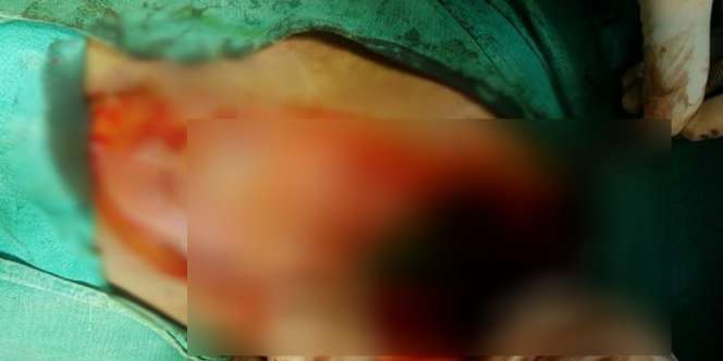 Kehilangan Nafsu Makan, Astaga usai Dicek Perutnya...