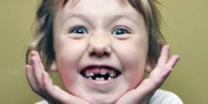 Akibat Gigi Susu Anak Rusak