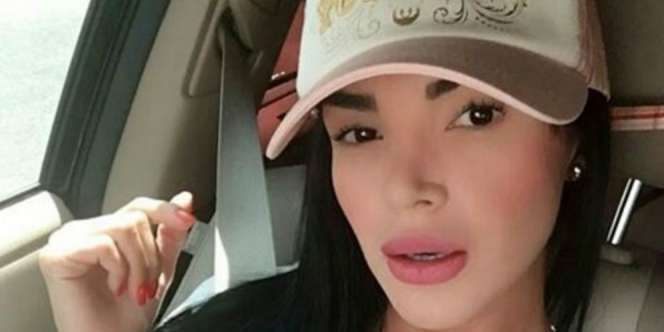 Rela Jalani 25 Kali Operasi Demi Bentuk Pinggang Seperti Gitar