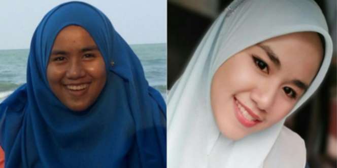 Pernah Dijuluki 'Badak', Gadis Ini Kini Tampil Mempesona