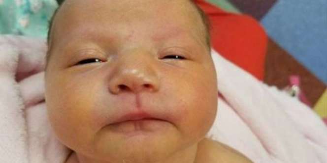  Miris, Bayi 18 Hari Meninggal karena Tertular Virus Herpes