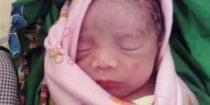 Tulisan Allah Muncul di Dahi Bayi Ini Jika Dibacakan Alquran
