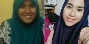 Dulu Di-bully, Kini Para Pria Berebut Kenalan dengan Cewek Ini