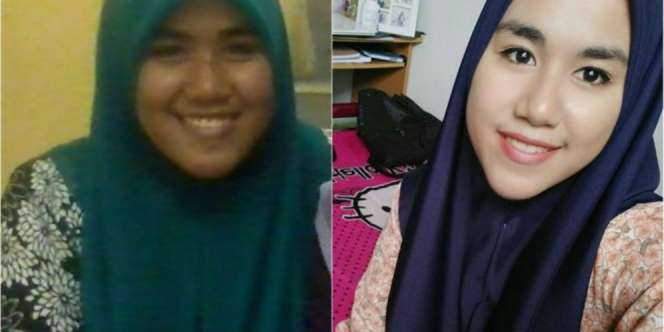 Dulu Di-bully, Kini Para Pria Berebut Kenalan dengan Cewek Ini