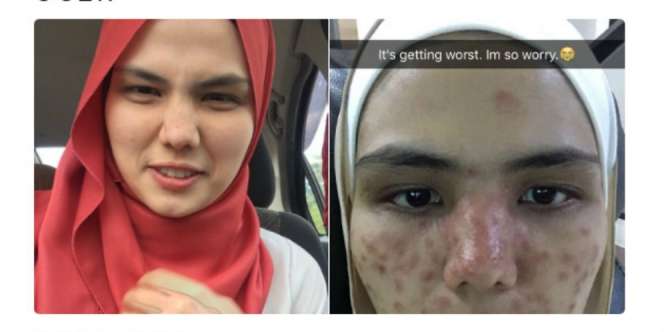 Cuma Karena Bintik Hitam, Si Gadis Temui Pakar dan Hasilnya..