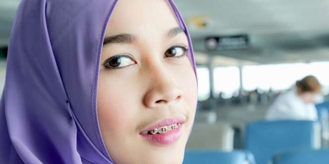 Pakai Kawat Gigi? Ini Tips Menjaga Gigi Tetap Putih