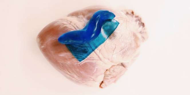 Peneliti Temukan Perekat Bedah untuk Hati