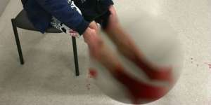 Kaki Berdarah, Nyaris Putus Dimakan Ribuan Hewan Mengerikan