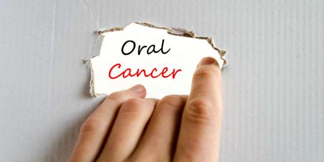 Hati-hati! Cara Berhubungan Intim Ini Bisa Picu Kanker Lidah