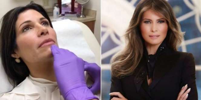 Obsesi Mirip Istri Donald Trump, Wanita Ini Rela Jalani Apapun