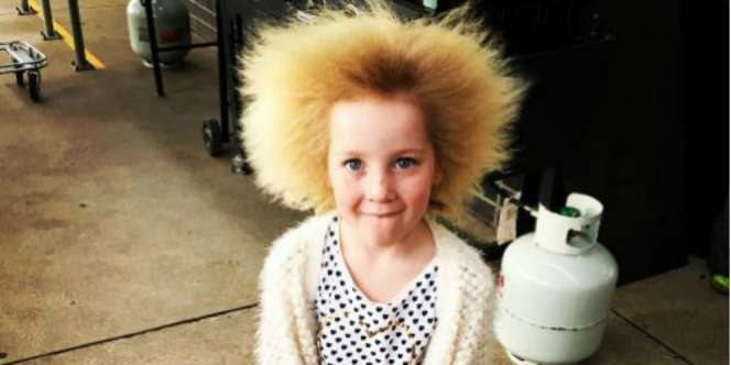Jabriknya Mirip Einstein, Bocah Ini Punya Rambut Langka 