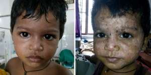 Gara-gara Orangtua Percaya Ilmu Hitam, Wajah Anaknya Jadi...