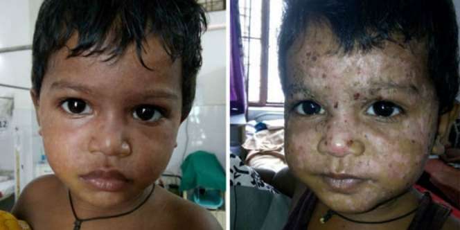 Gara-gara Orangtua Percaya Ilmu Hitam, Wajah Anaknya Jadi...