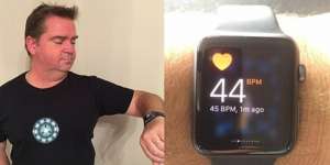 Apple Akan Rilis Arloji Canggih Anyar, Bisa 'Bunuh' Ponsel?