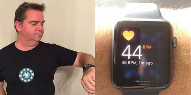 Apple Akan Rilis Arloji Canggih Anyar, Bisa 'Bunuh' Ponsel?