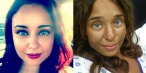 Cewek Cantik Ini Hilang Sebulan di Hutan, Wajahnya Berubah...