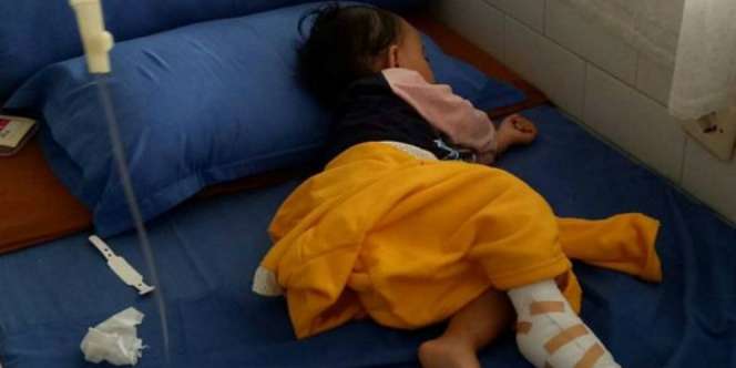 Lagi, Cerita Sedih Anak Terkena Pneumonia Berat karena Rokok