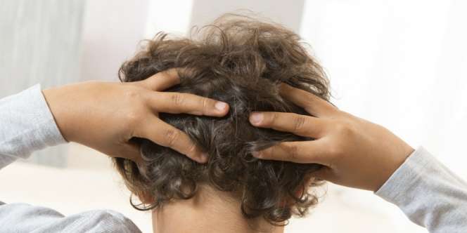 Cara Usir Kutu Rambut Pakai Bahan Rumahan