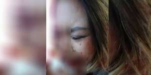 Wanita WNI Dipukuli di Korea, Astaga Penyebabnya Bikin Geram