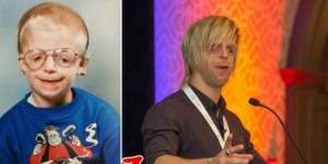 Jono Dibuang karena Buruk Rupa, Begini Nasibnya Kini