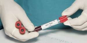 Ilmuwan Klaim Temukan Obat Mujarab Pencegah Virus HIV