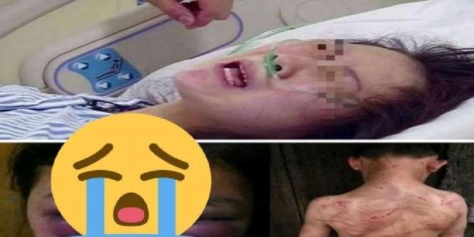 Siksa Anak Tiri hingga Tewas, Si Ibu Kena Azab Saat Lahiran
