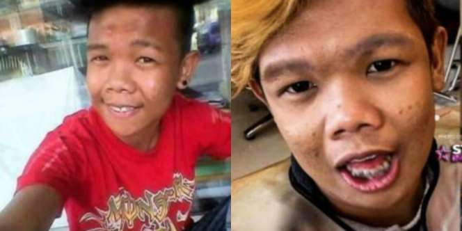 Berbakat Tapi Dihina karena Penampilan, Mengejutkan Sekarang..