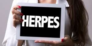 Manusia Pertama Pembawa Virus Herpes Genital