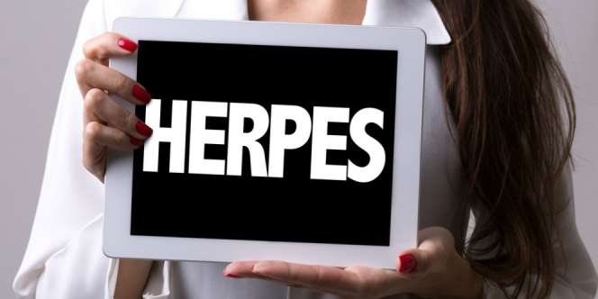Manusia Pertama Pembawa Virus Herpes Genital