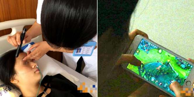 Bermain Game Tanpa Henti, Mata Gadis Ini Buta Sebelah