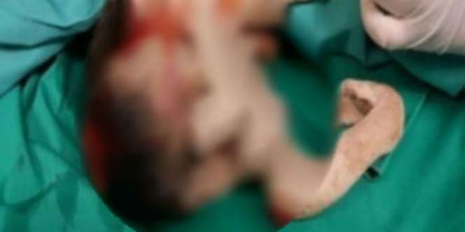 Ada Janin di Perut Remaja Laki-laki Berusia 15 Tahun