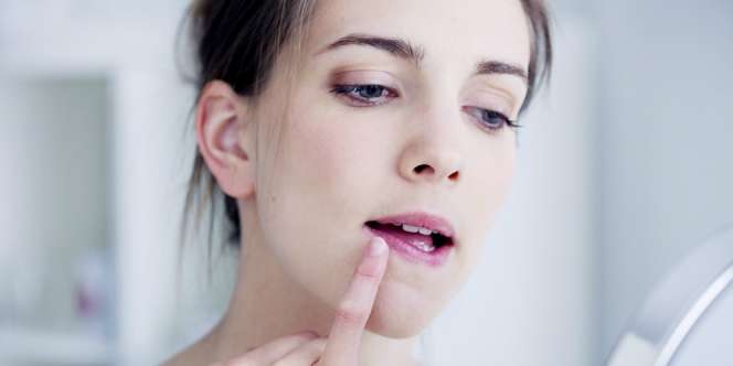 6 Bahan Alami Atasi Bibir Pecah-pecah