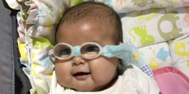 Lucunya Anak Asri Welas Jalani Terapi Oral