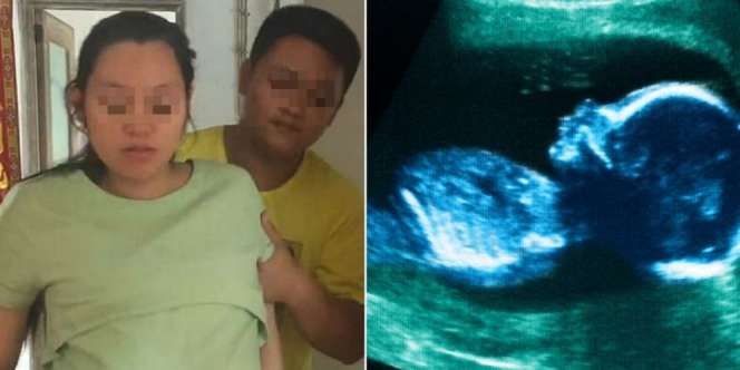 Aborsi karena Mau Anak Laki-laki, Lihat yang Dialami Si Ibu