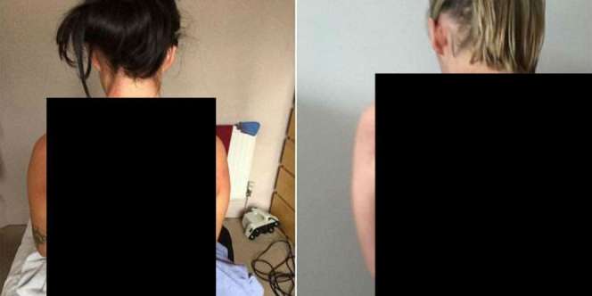 Sebar Foto Kerokan, Wanita Ini Bikin Heboh