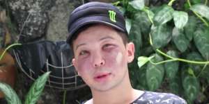 Mau Lebih Feminin, Astaga Wajah Si Pria Membusuk